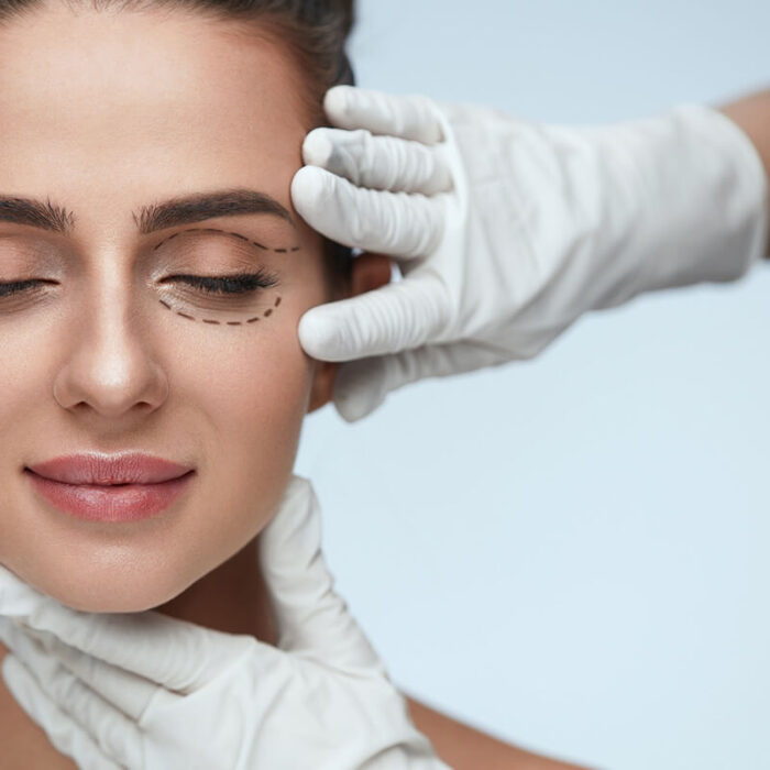 blefaroplastica che cose e costi