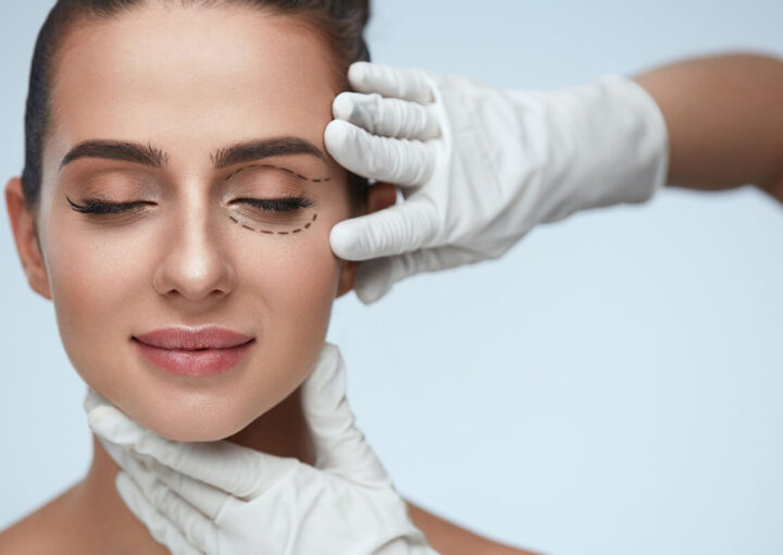 blefaroplastica che cose e costi